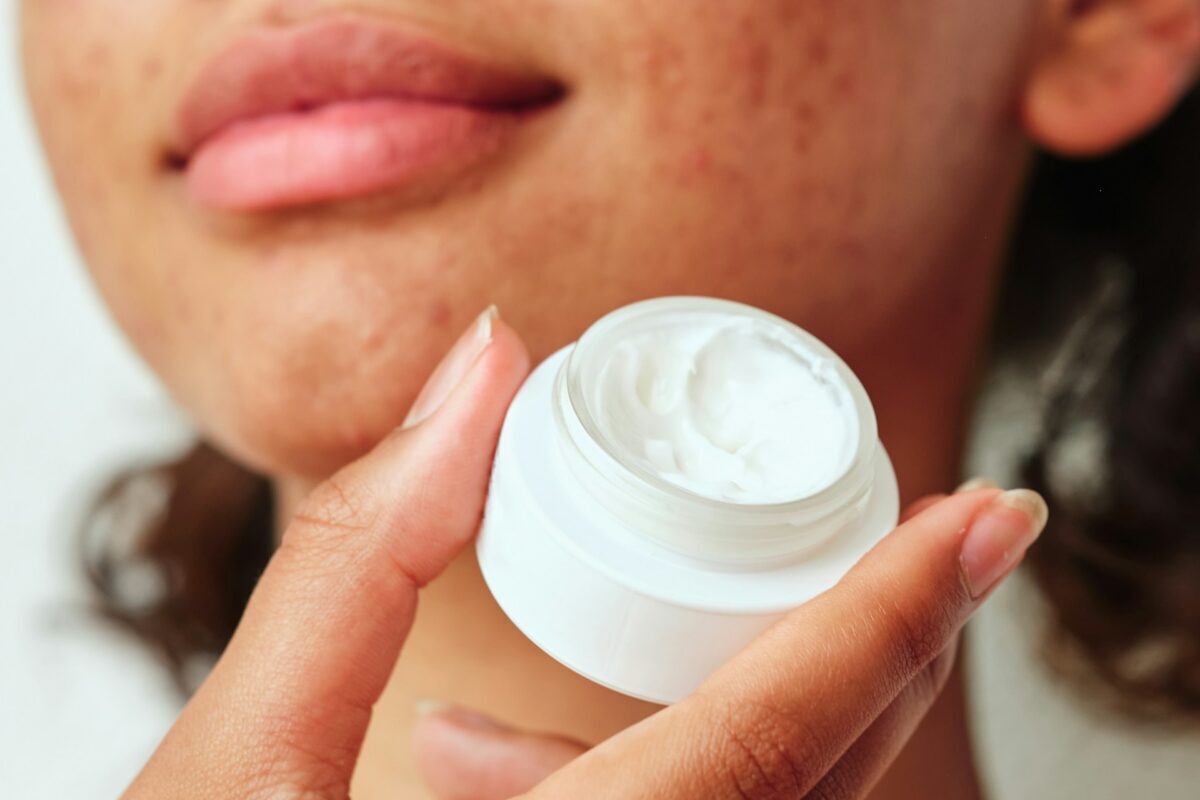 Person holding acne treatment cream to improve stubborn acne problems with professional skincare solutions.