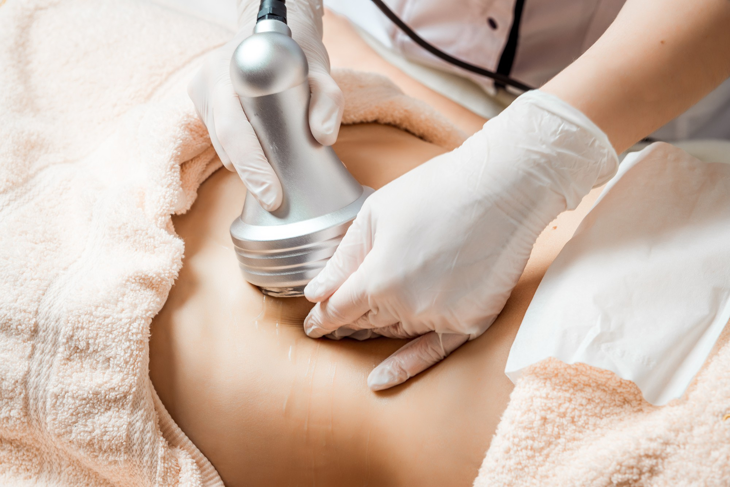 Patient receiving a body contouring treatment representing planning and care around body contouring surgery.
