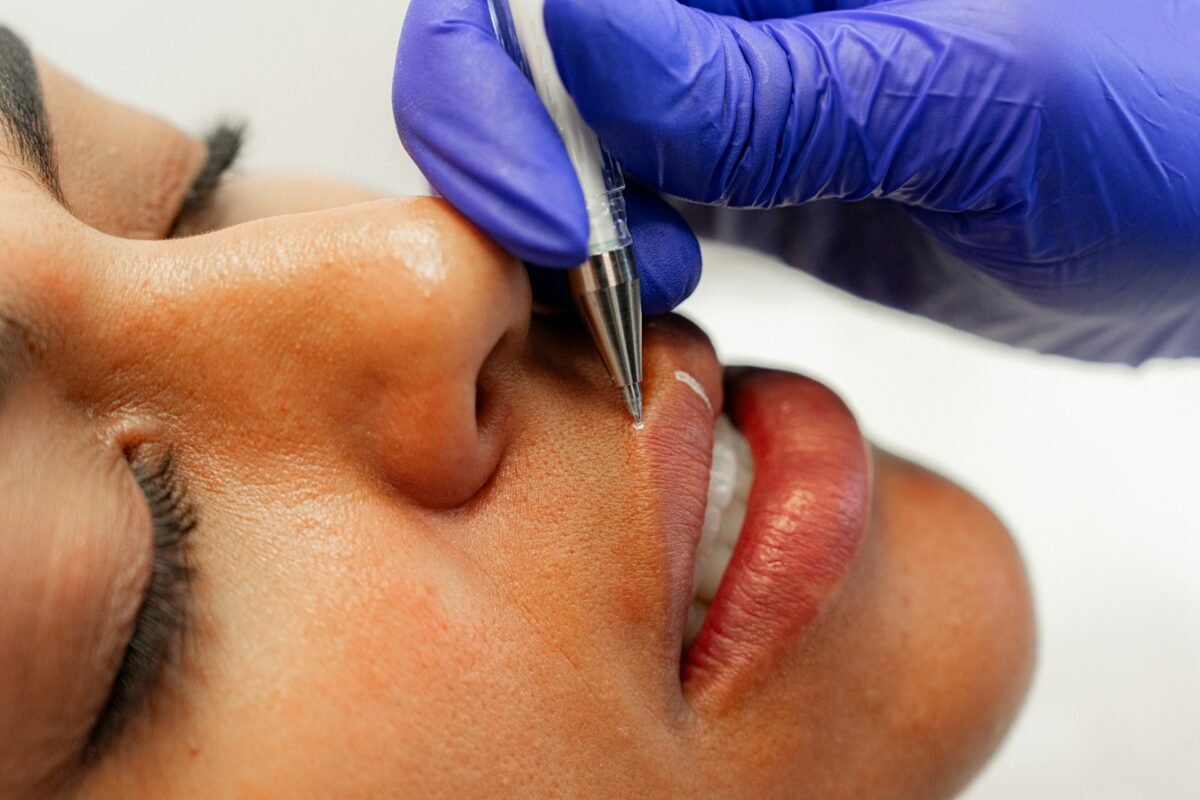 Provider marking a patient's face before a cosmetic surgery procedure consultation.